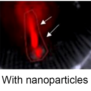 Spotting — and hearing — heart attacks before they strike
